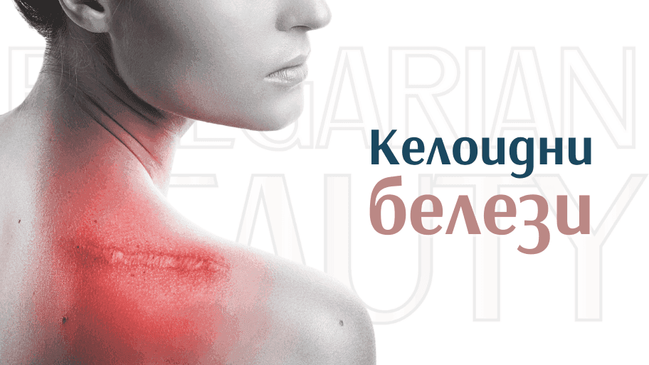 келоидни белези